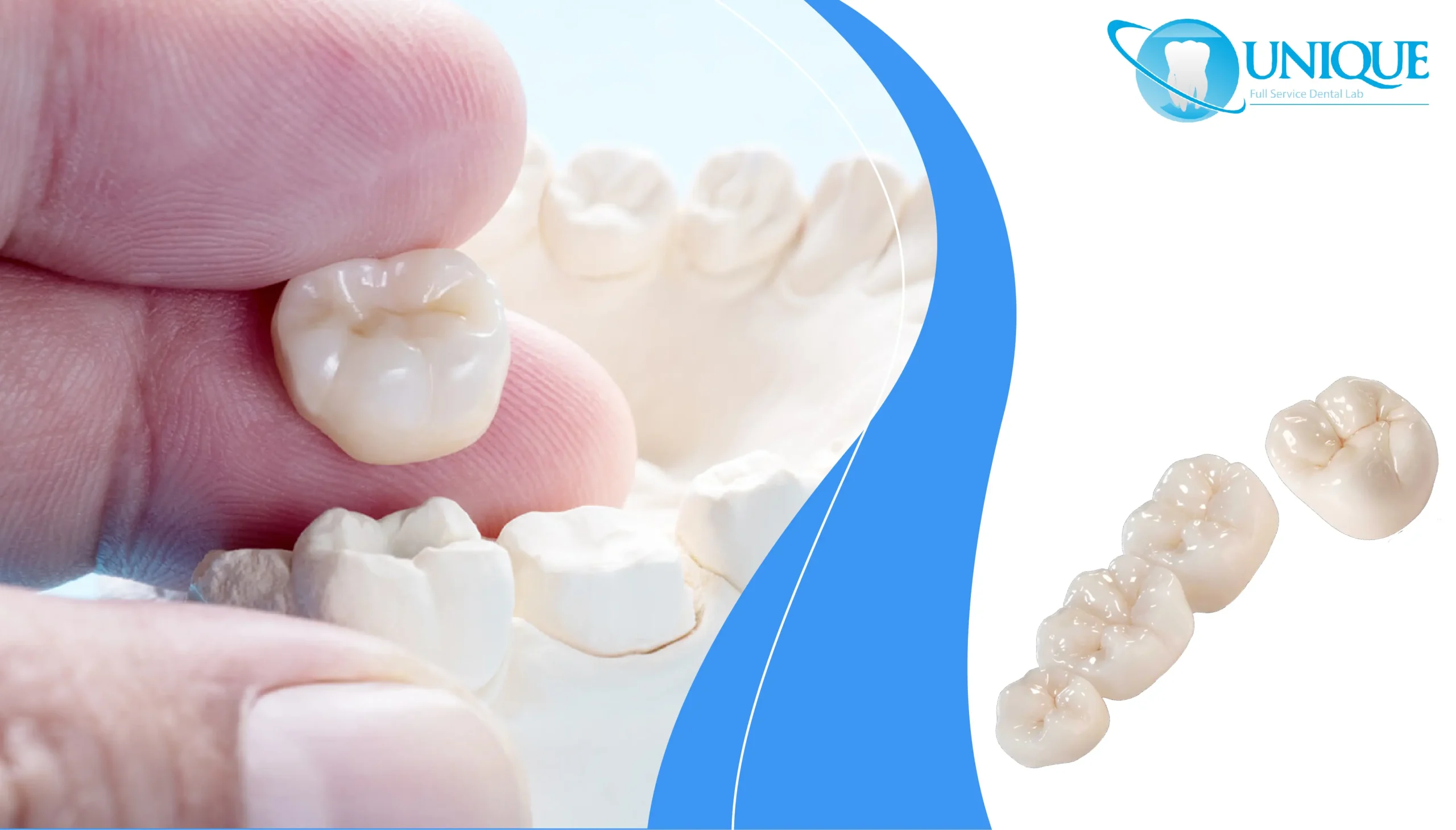 finger-showing-the-fit-of-dental-crown-and-cast-model-with-dental-crowns-on-side
