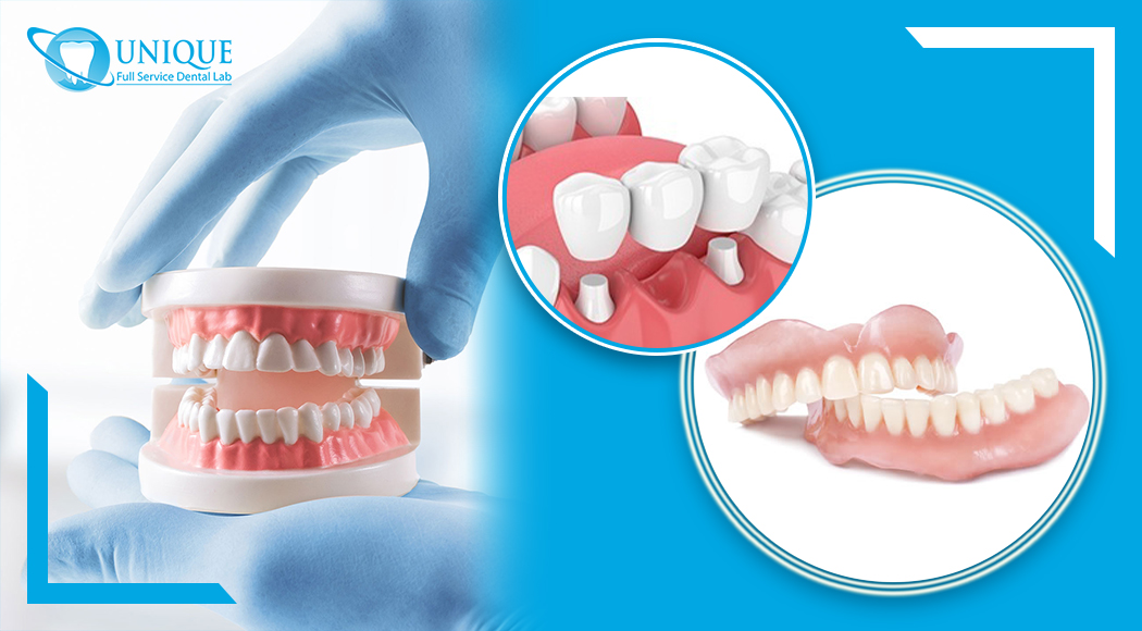 dental-bridge-and-hand-holding-teeth-and-jaw-model-with-removable-partial-dentures