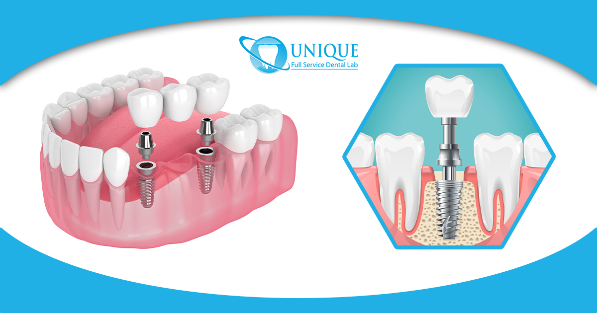 3d-render-of-jaw-and-implants-with-dental-bridge-and-3d-illuistration-of-a-dental-implant-installation
