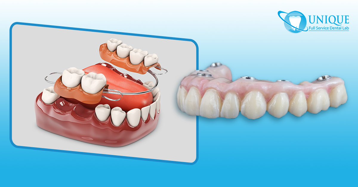 full-arch-zirconia-milled--dental-implant-and-partial-dentures-with-metal-clasps
