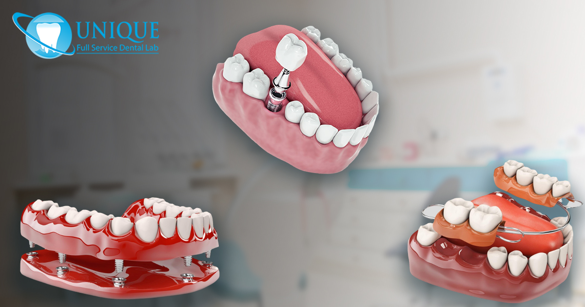 hand-holding-teeth-model-with-braces-above-clear-retainer-removable-denture-teeth-model-holding-dental-tool-and-dental-casts