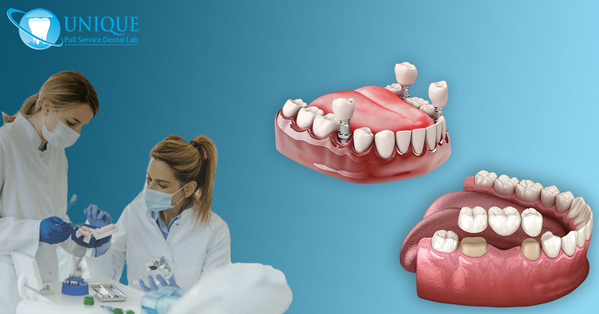 installation-of-dental-bridge-3d-render-of-8overdenture-implants-on-dental-prosthesis-and-3d-illustration-of-human-teeth-and-dental-implant