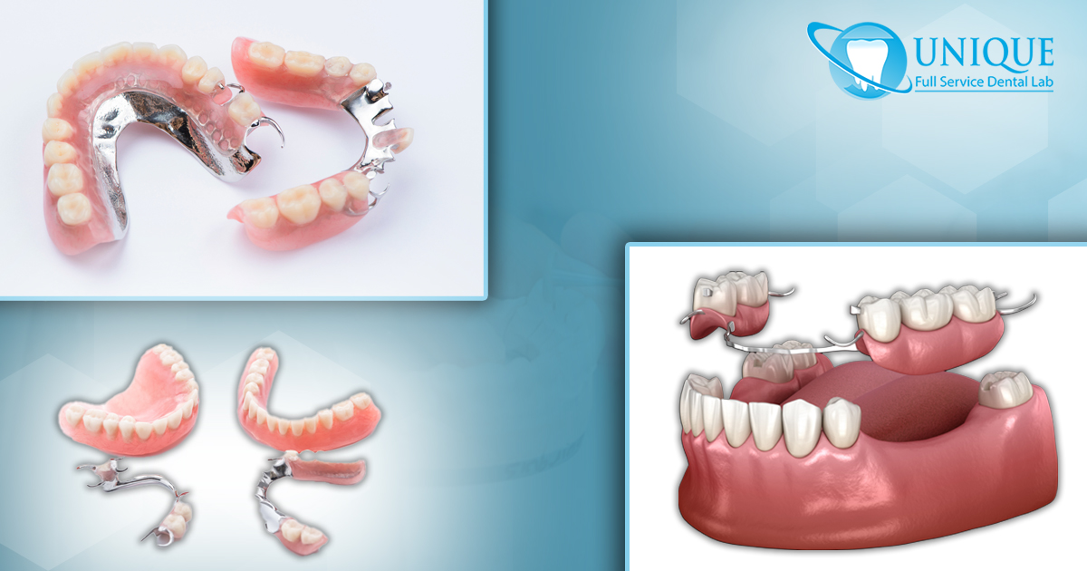some-flexible-partial-dentures-alternatives